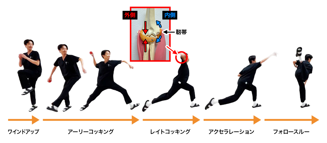 野球肘1