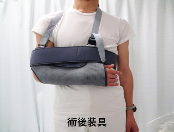 肩関節脱臼（反復性脱臼）2